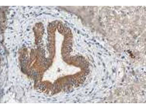 Fbp5A Antibody in Immunohistochemistry (Paraffin) (IHC (P))