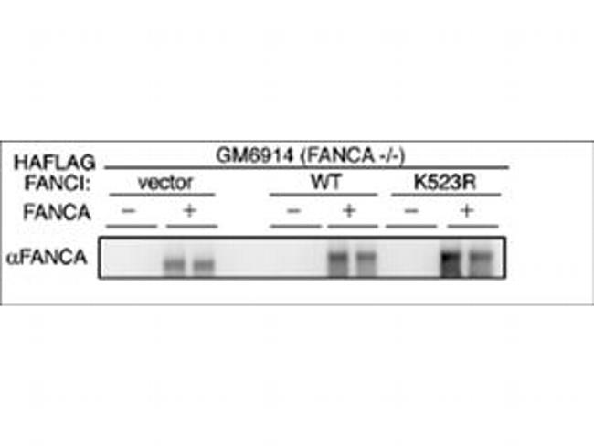 FANCA Antibody in Western Blot (WB)