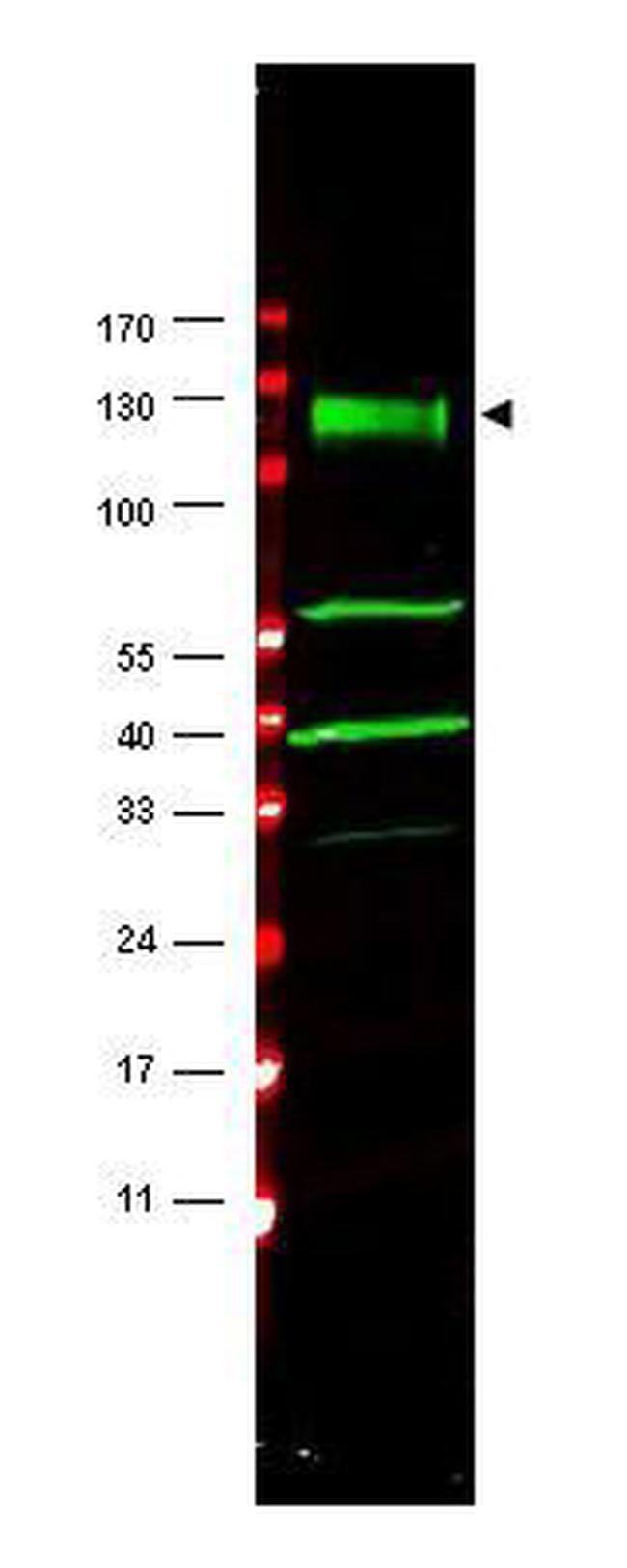 FANCA Antibody in Western Blot (WB)