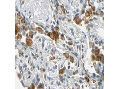 FANCG Antibody in Immunohistochemistry (Paraffin) (IHC (P))