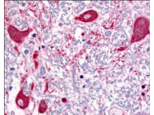 ROBO-1 Antibody in Immunohistochemistry (Paraffin) (IHC (P))