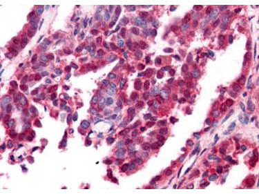 EGR-1 Antibody in Immunohistochemistry (Paraffin) (IHC (P))