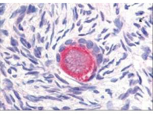 Delta-4 Antibody in Immunohistochemistry (Paraffin) (IHC (P))