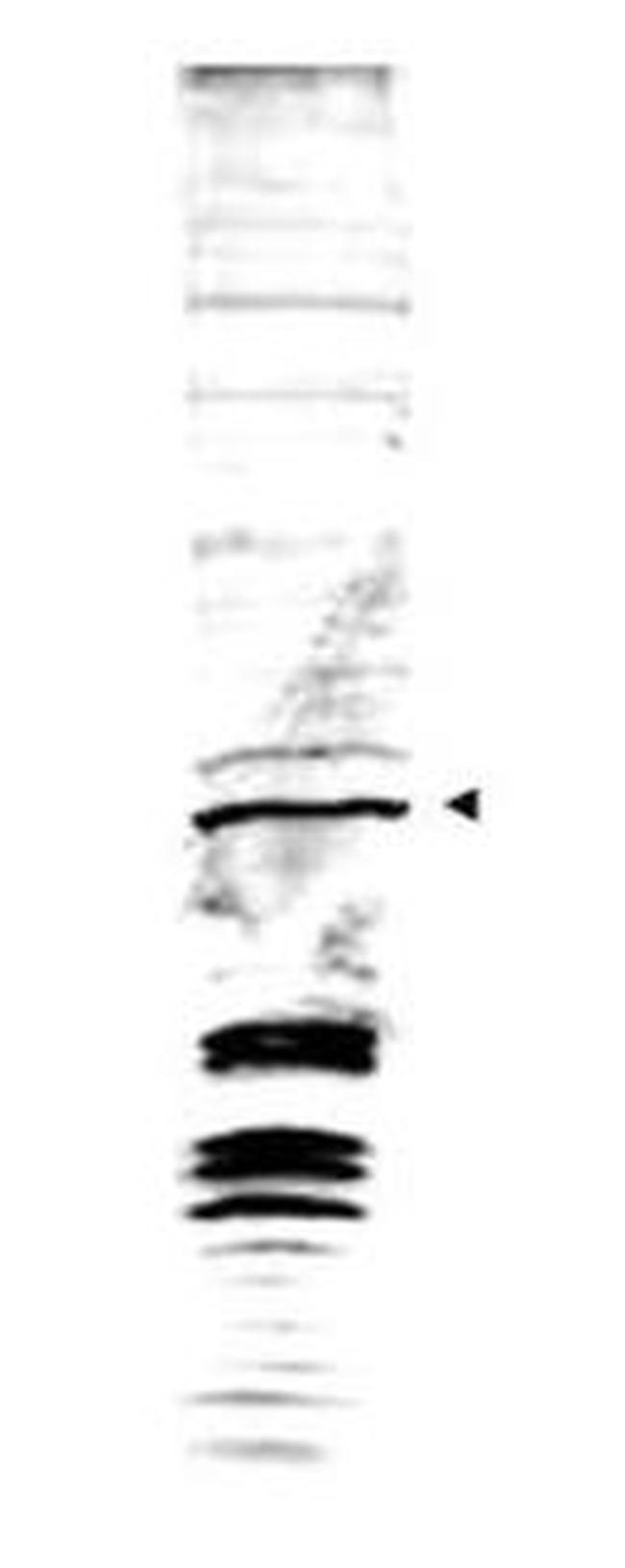 Swi6 Antibody in Western Blot (WB)