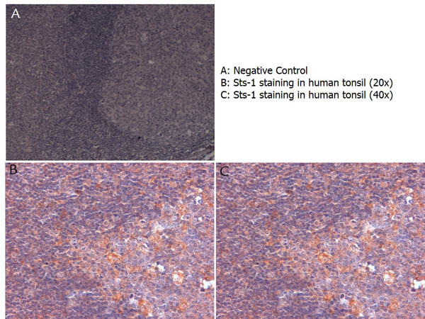 Sts-1 Antibody in Immunohistochemistry (Paraffin) (IHC (P))