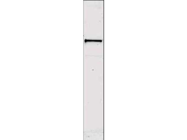 Sts-1 Antibody in Western Blot (WB)