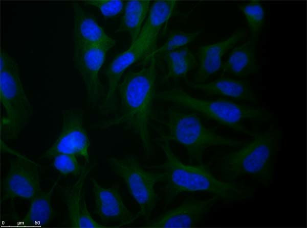 alpha-Tubulin Antibody in Immunocytochemistry (ICC/IF)