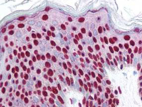 Phospho-SMAD3 (Ser423, Ser425) Antibody in Immunohistochemistry (Paraffin) (IHC (P))