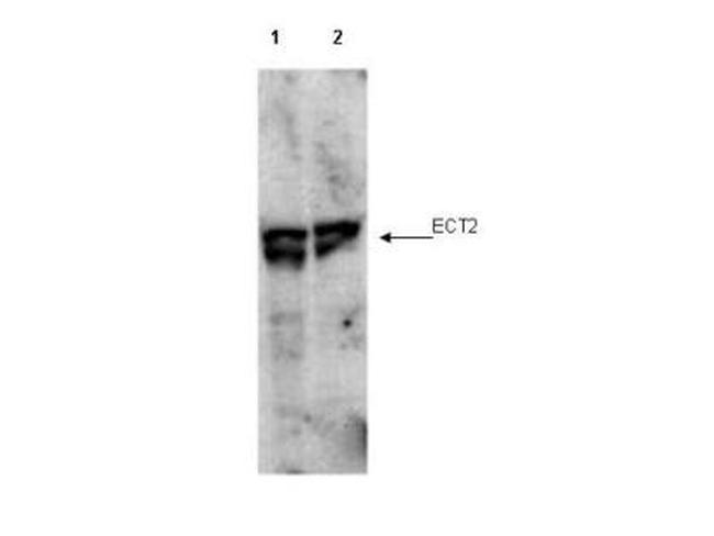 Phospho-ECT2 (Thr790) Antibody in Western Blot (WB)