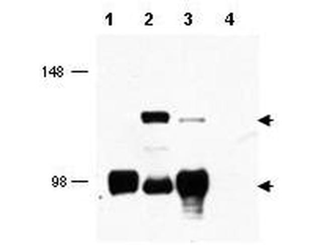 MECT1 Antibody in Western Blot (WB)