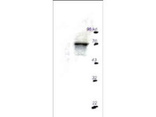 p70 S6 Kinase Antibody in Western Blot (WB)