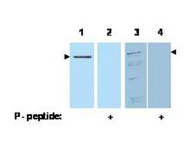 Phospho-Pdcd4 (Ser457) Antibody in Western Blot (WB)