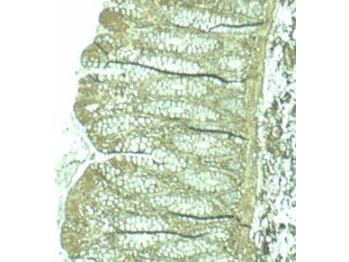 Pdcd4 Antibody in Immunohistochemistry (Paraffin) (IHC (P))