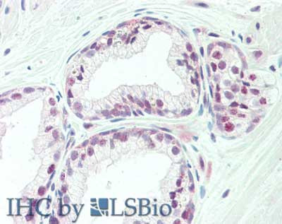 TAF1 Antibody in Immunohistochemistry (Paraffin) (IHC (P))