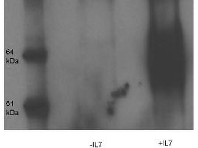 Phospho-IL-7 Receptor alpha Chain (Tyr449) Antibody in Western Blot (WB)