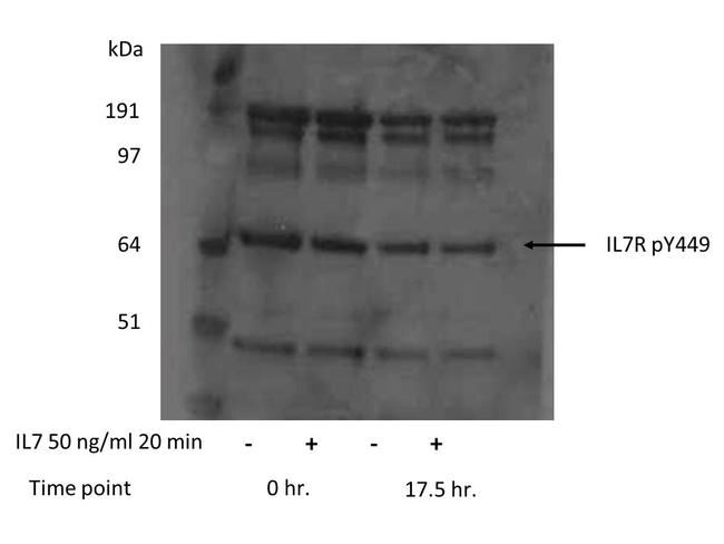 Phospho-IL-7 Receptor alpha Chain (Tyr449) Antibody in Western Blot (WB)