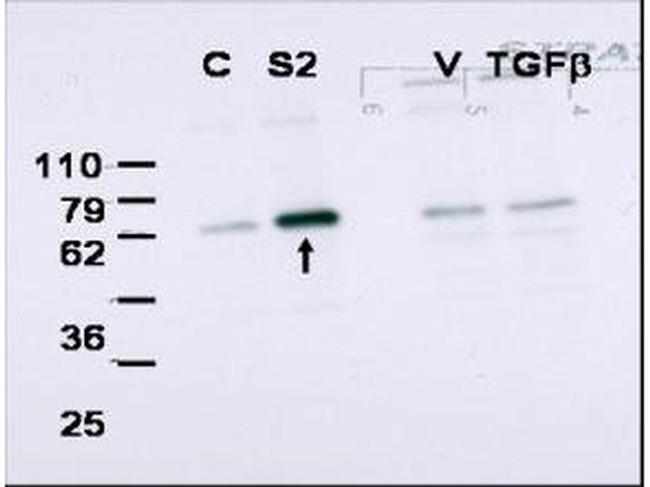 SMAD2 Antibody in Western Blot (WB)