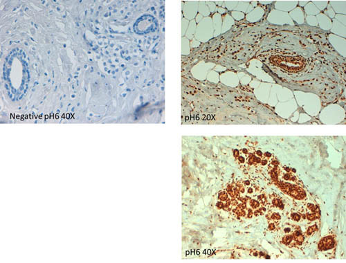 ABCB5 Antibody in Immunohistochemistry (Paraffin) (IHC (P))