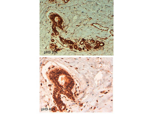 ABCB5 Antibody in Immunohistochemistry (Paraffin) (IHC (P))