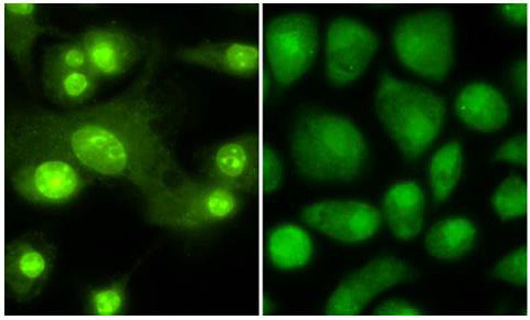 Thyroid Hormone Receptor beta 1 Antibody in Immunocytochemistry (ICC/IF)