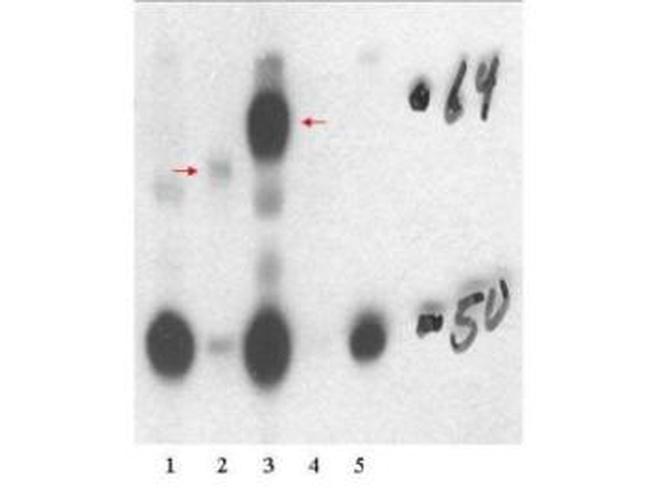 Thyroid Hormone Receptor beta 1 Antibody in Western Blot (WB)