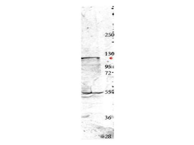 NEDD4 Antibody in Western Blot (WB)