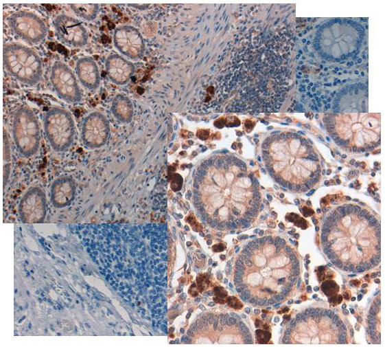 NAG-1 Antibody in Immunohistochemistry (IHC)