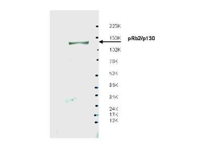 pRb2 p130 Antibody in Western Blot (WB)