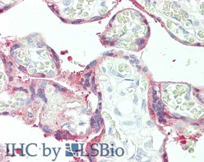 Plasminogen Activator Inhibitor 2 Antibody in Immunohistochemistry (Paraffin) (IHC (P))