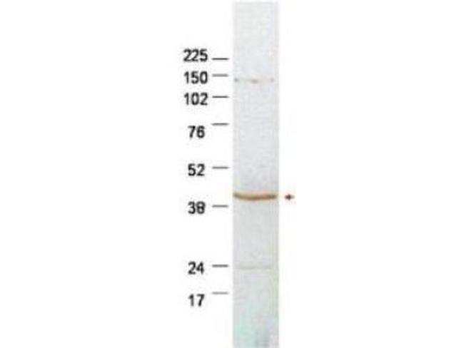 Plasminogen Activator Inhibitor 2 Antibody in Western Blot (WB)