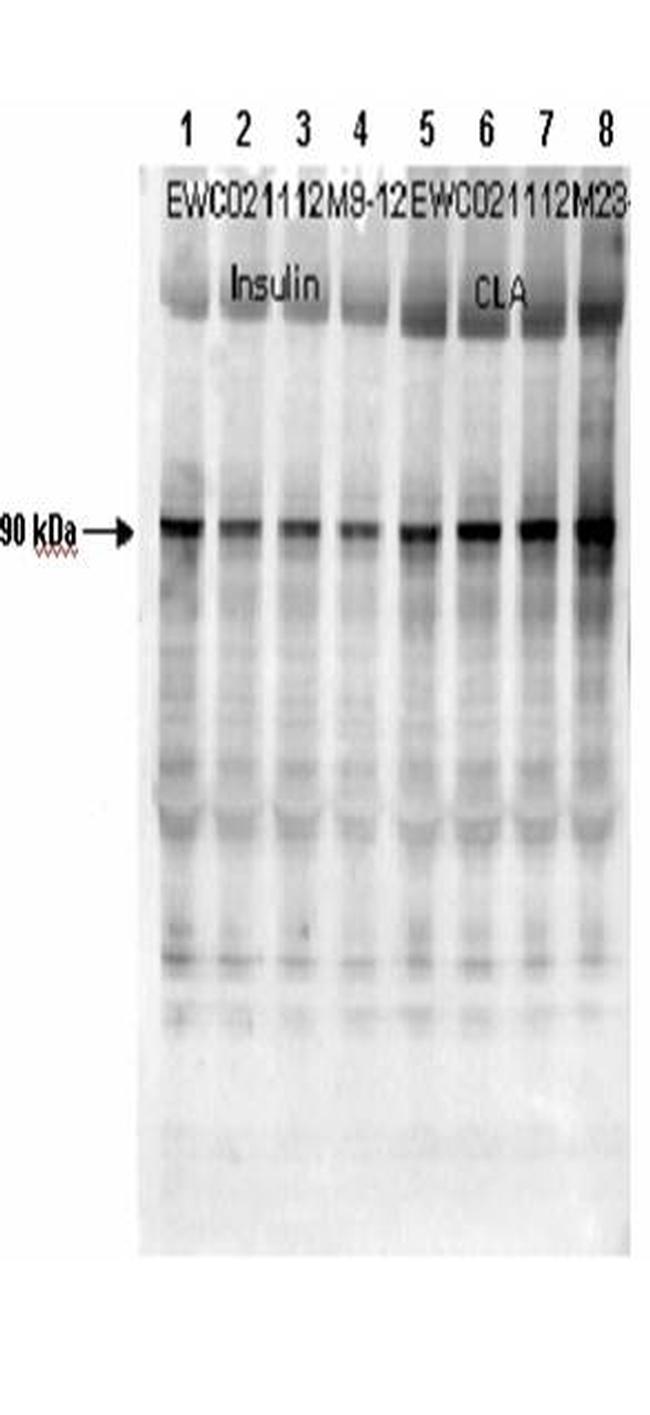 Phospho-Muscle Glycogen Synthase (Ser641) Antibody in Western Blot (WB)