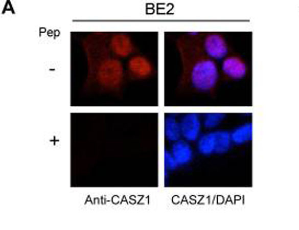 CASZ1 Antibody in Immunocytochemistry (ICC/IF)