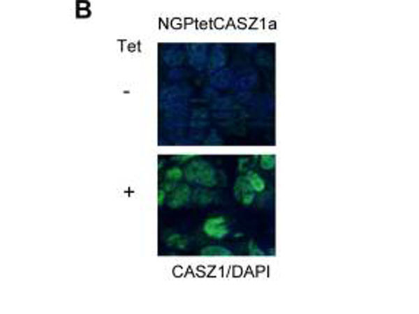 CASZ1 Antibody in Immunohistochemistry (IHC)
