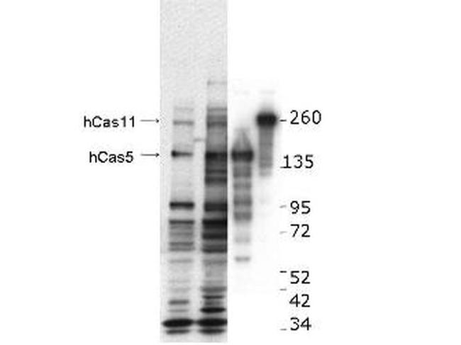 CASZ1 Antibody in Western Blot (WB)