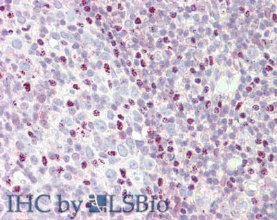 CTCF Antibody in Immunohistochemistry (Paraffin) (IHC (P))