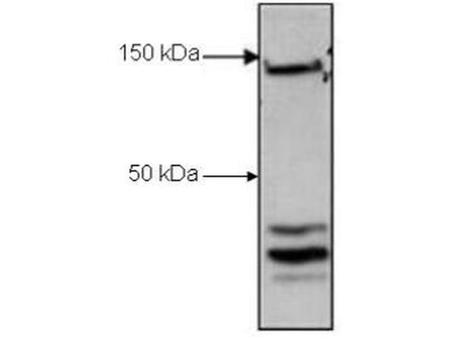 CTCF Antibody in Western Blot (WB)