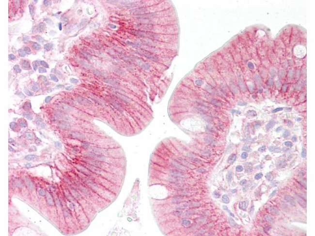 beta Catenin Antibody in Immunohistochemistry (Paraffin) (IHC (P))