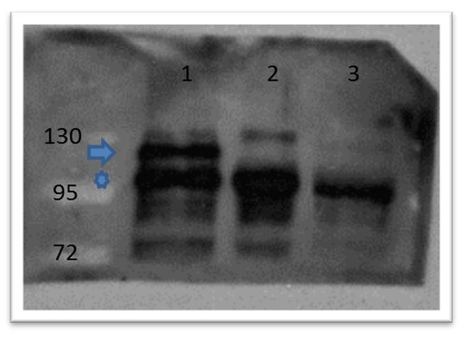 beta Catenin Antibody in Western Blot (WB)