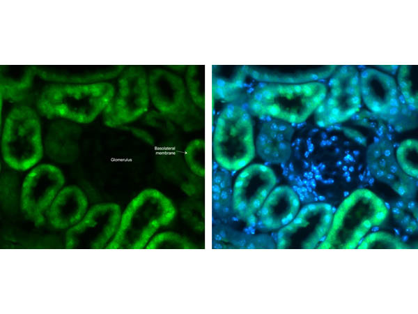 Glut2 Antibody in Immunohistochemistry (IHC)