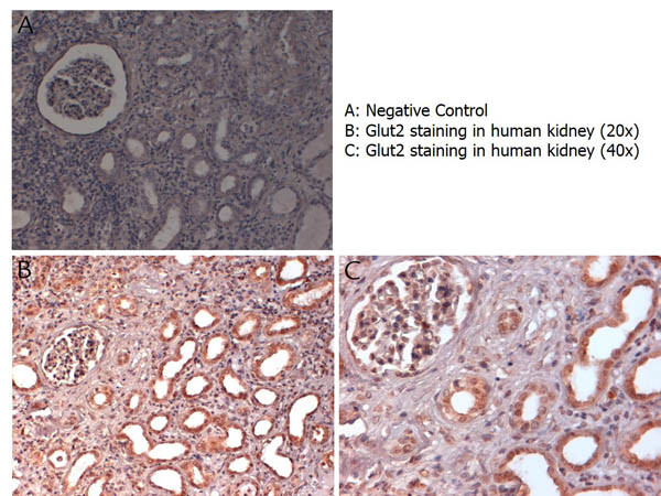 Glut2 Antibody in Immunohistochemistry (Paraffin) (IHC (P))