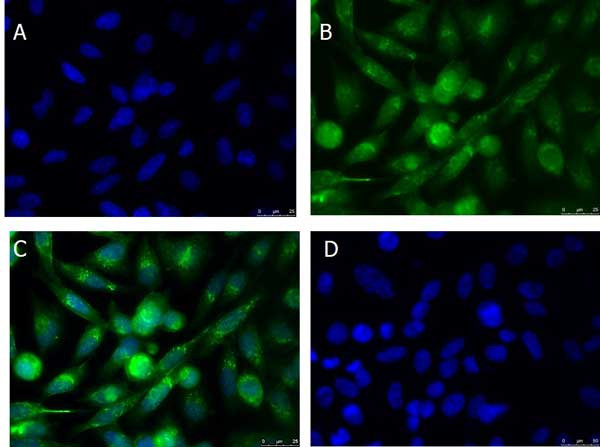 xCT Antibody in Immunocytochemistry (ICC/IF)