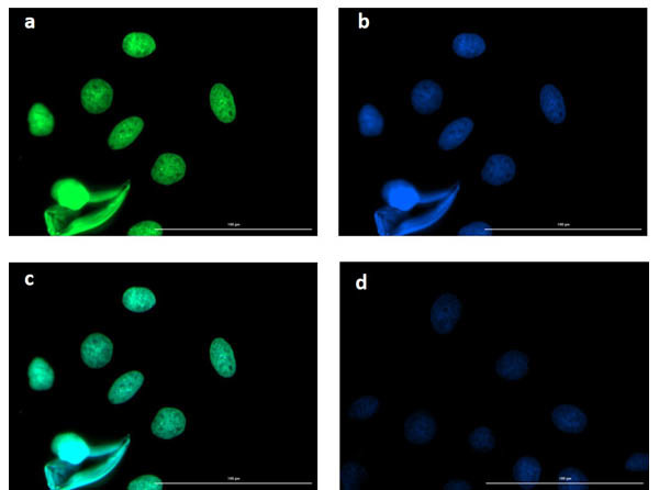 BCL3 Antibody in Immunocytochemistry (ICC/IF)