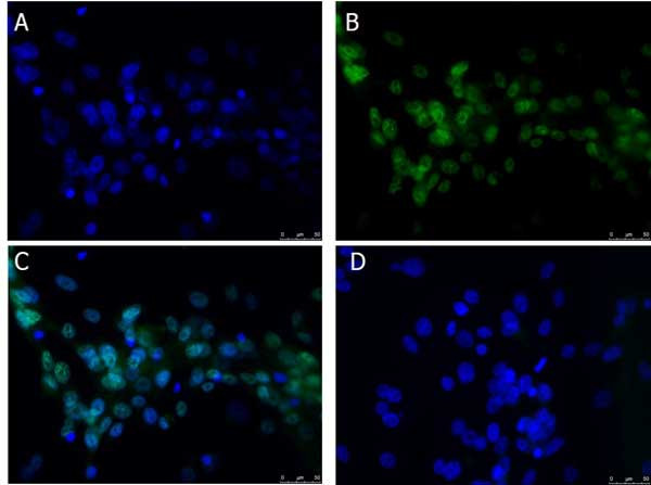 BCL3 Antibody in Immunocytochemistry (ICC/IF)