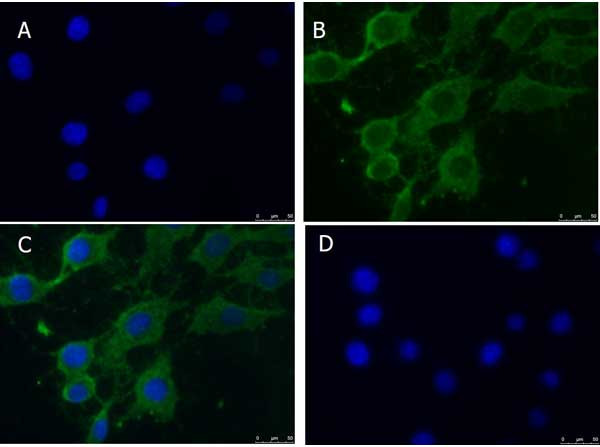 PINK1 truncated Antibody in Immunocytochemistry (ICC/IF)