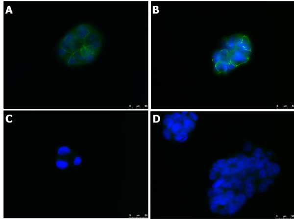 ZO-1 Antibody in Immunocytochemistry (ICC/IF)