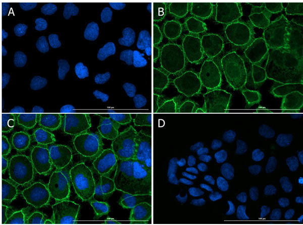 ZO-1 Antibody in Immunocytochemistry (ICC/IF)