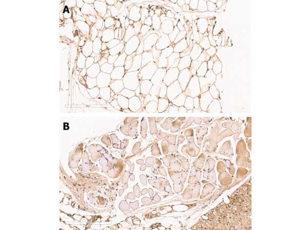 ZO-1 Antibody in Immunohistochemistry (Paraffin) (IHC (P))