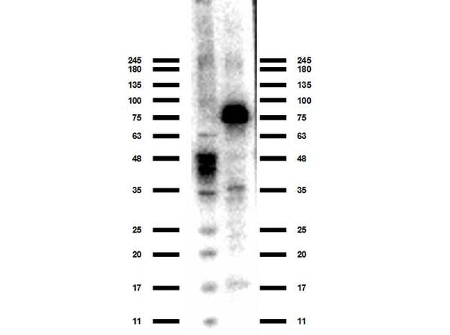 ACSS2 Antibody in Western Blot (WB)