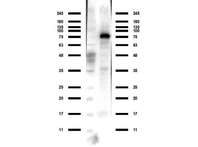 ACSS2 Antibody in Western Blot (WB)