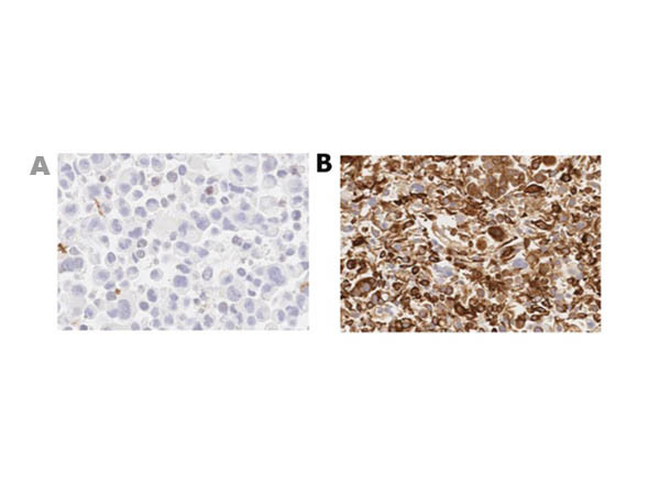 MUC4 Antibody in Immunocytochemistry (ICC/IF)